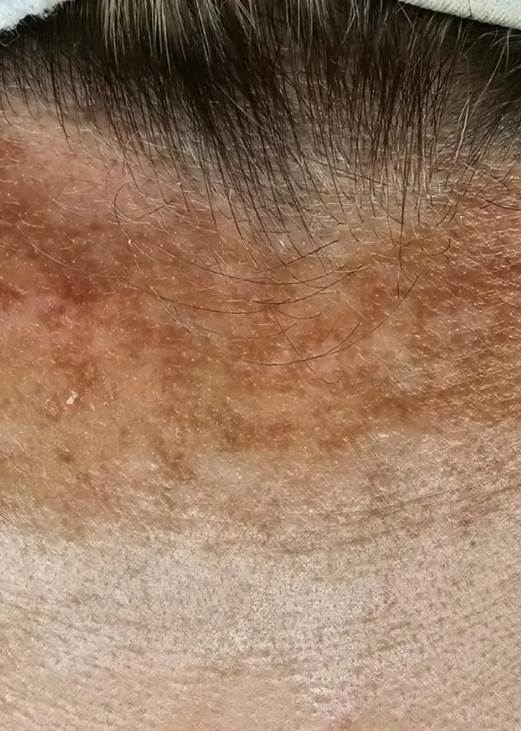 Pre