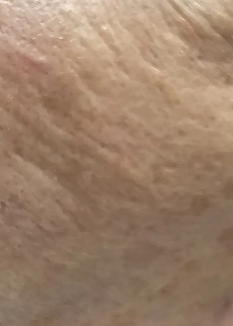 Pre